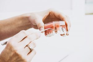 implant-dentiste-sion