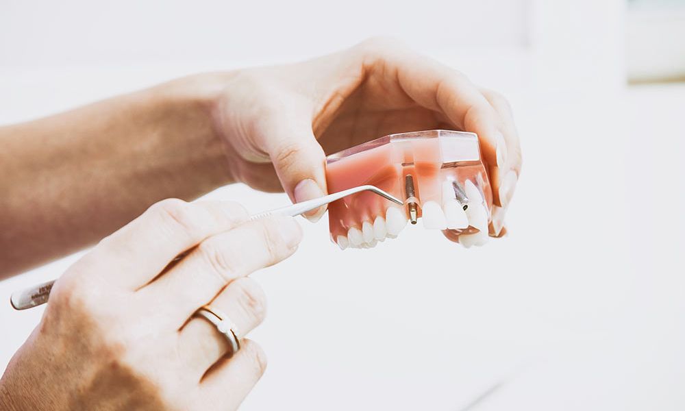 implant dentiste sion 1 490e4043
